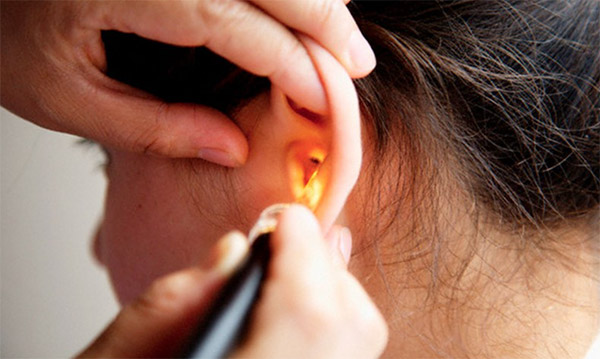 Tratamientos más exitosos para tratar la pérdida de audición